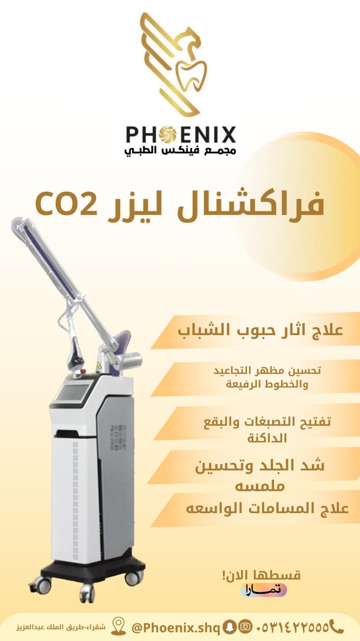 فراكشنال ليزر